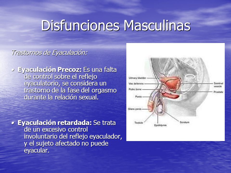 eyaculación tardía versus disfunción eréctil